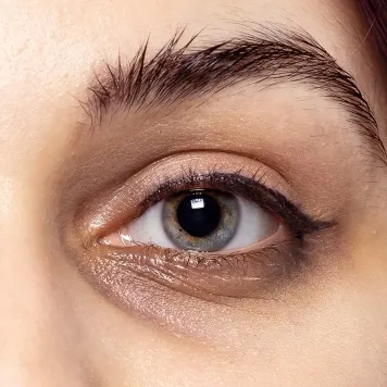 Dark Circles and Puffiness