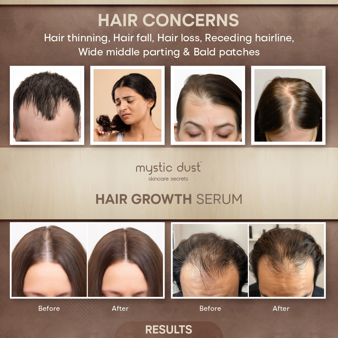Hair Growth Serum